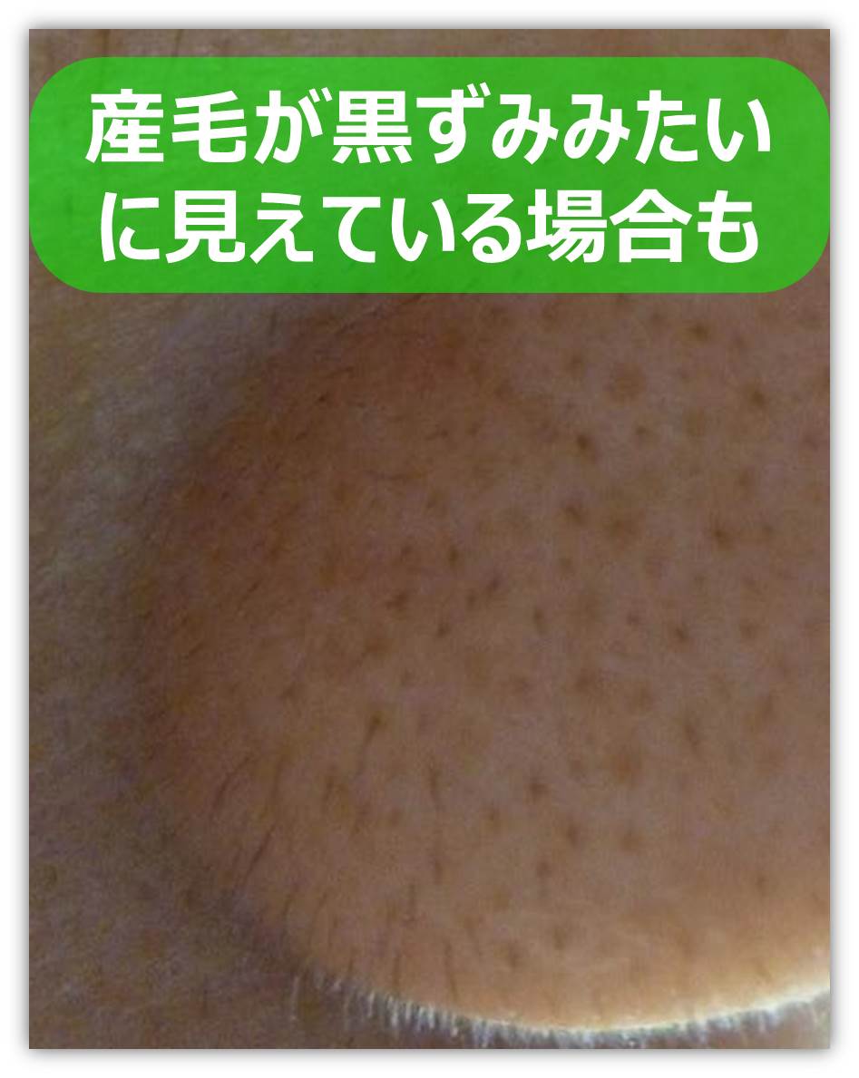 鼻の産毛.jpg